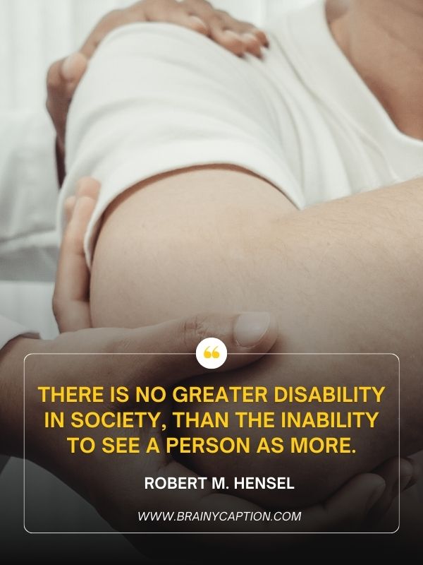 Motivational Quotes For Physically Challenged- There is no greater disability in society, than the inability to see a person as more